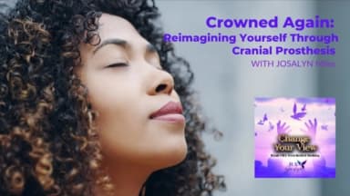 Crowned Again: Reimagining Yourself Through Cranial Prosthesis